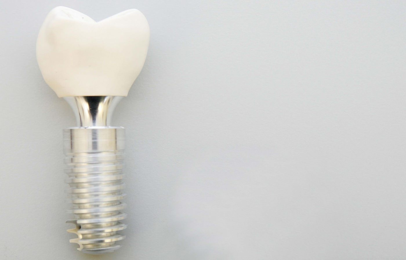 Zahnimplantat Salzburg